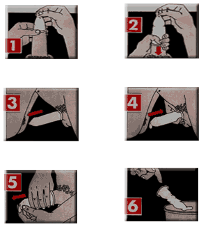 male-condom.gif